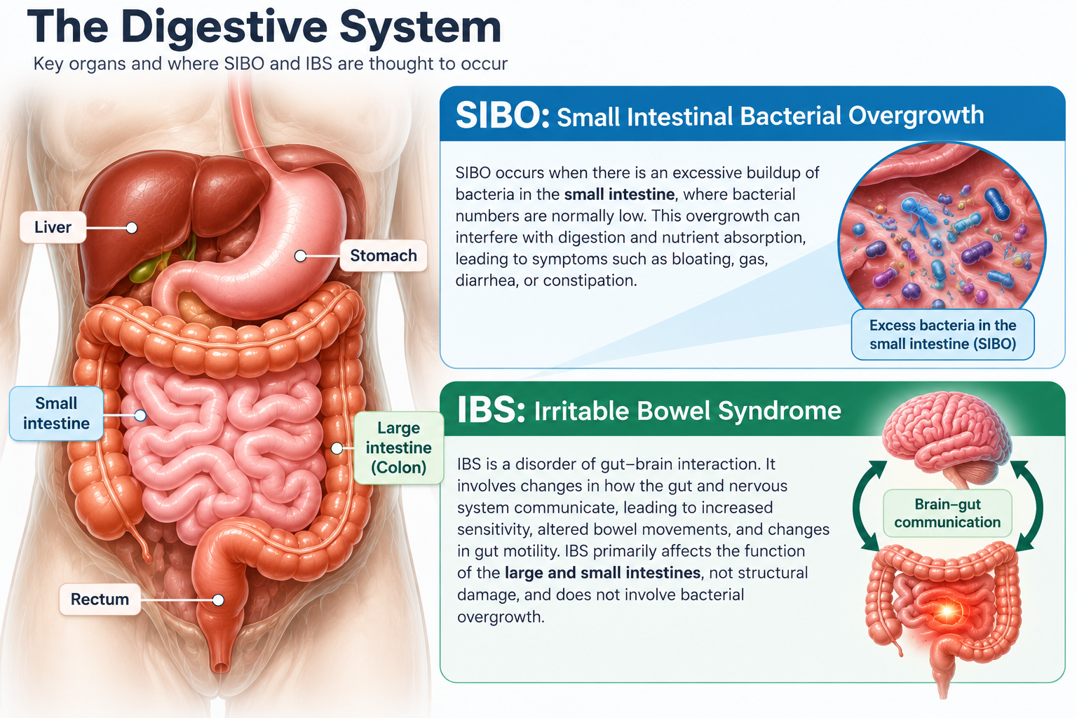 Digestive system anatomy showing the small intestine, colon, SIBO bacterial overgrowth and IBS gut-brain interaction